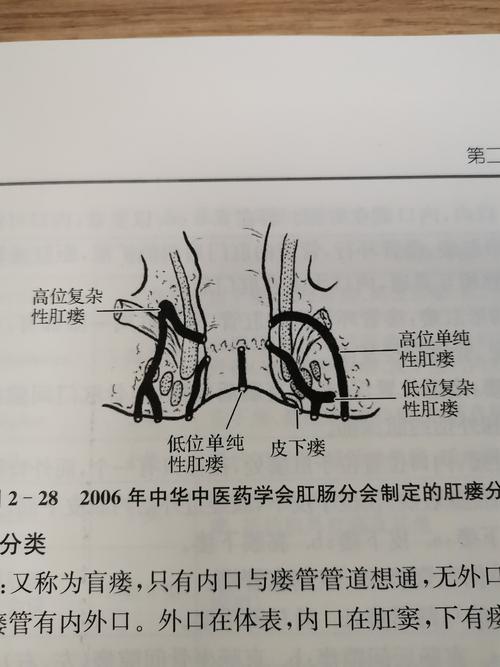 传输端点尚未连接（肛周脓肿高位脓肿怎么发现）